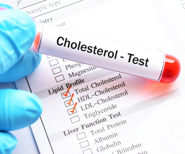 colesterol-mitos-e-verdades-lendas-e-duvidas